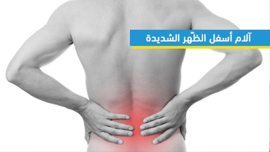 آلام أسفل الظّهر الشديدة