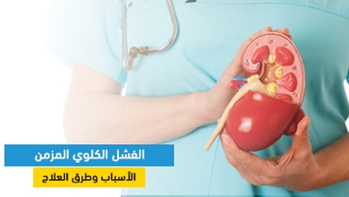  الفشل الكلوي المزمن: الأسباب وطرق العلاج 