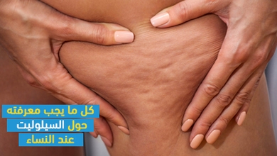 كل ما يجب معرفته حول السيلوليت عند النساء