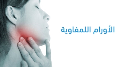 الأورام اللمفاوية