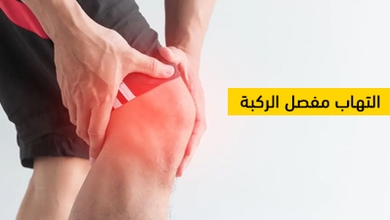 التهاب مفصل الركبة