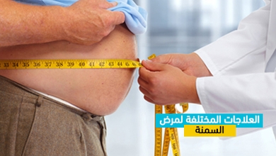 العلاجات المختلفة لمرض السمنة