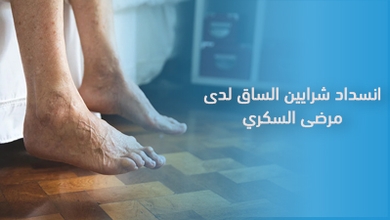 انسداد شرايين الساق لدى مرضى السكري