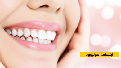 ابتسامة هوليوود