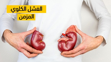 الفشل الكلوي المزمن