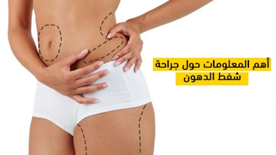 أهم المعلومات حول جراحة شفط الدهون