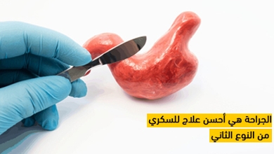 الجراحة هي أحسن علاج للسكري من النوع الثاني