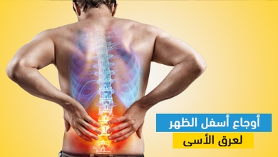 أوجاع أسفل الظهر لعرق الأسى