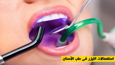 استعمالات الليزر في طب الأسنان