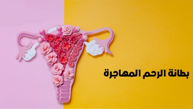 بطانة الرحم المهاجرة