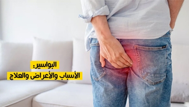 البواسير: الأسباب والأعراض والعلاج
