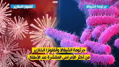 جرثومة الشيغالا وأنفلونزا الخنازير من أكثر الأمراض المنتشرة عند الأطفال