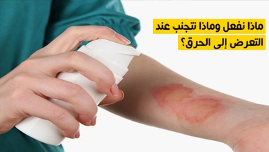 ماذا نفعل وماذا نتجنب عند التعرض إلى الحرق