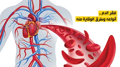 فقر الدم : أنواعه وطرق الوقاية منه