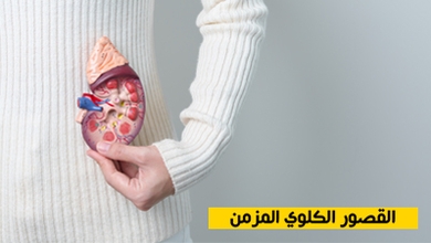 القصور الكلوي المزمن