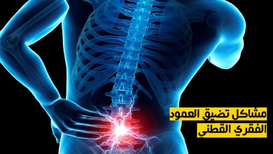 مشاكل تضيق العمود الفقري القطني
