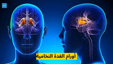 أورام الغدة النخامية