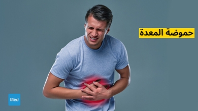 حموضة المعدة