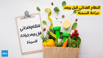 النظام الغذائي قبل وبعد جراحة السمنة