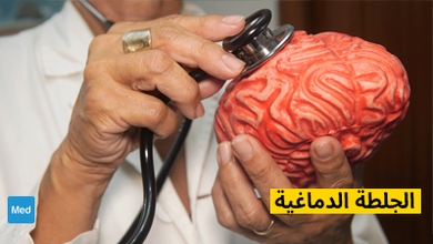 الجلطة الدماغية