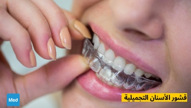 قشور الأسنان التجميلية