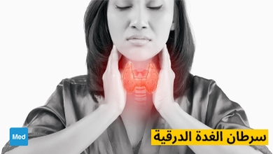 سرطان الغدة الدرقية