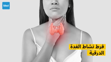 فرط نشاط الغدة الدرقية