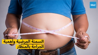 السمنة المرضية وأهمية الجراحة بالمنظار