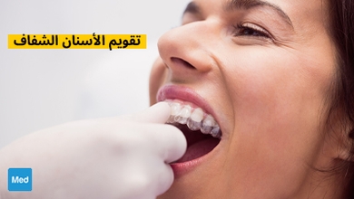 تقويم الأسنان الشفاف