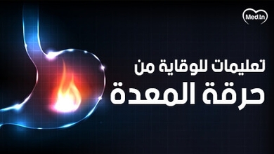 تعليمات للوقاية من حرقة المعدة
