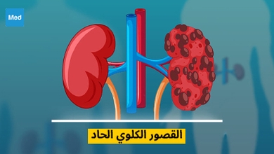 القصور الكلوي الحاد