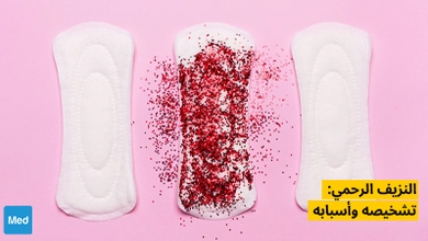 النزيف الرحمي: تشخيصه وأسبابه