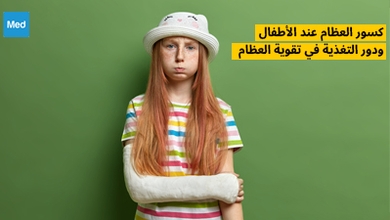 كسور العظام عند الأطفال ودور التغذية في تقوية العظام