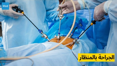 الجراحة بالمنظار