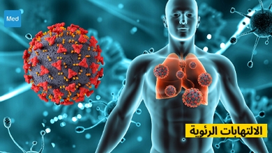 الالتهابات الرئوية