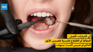 أي الخيارات أفضل : الحفاظ أو الاقتلاع بالنسبة للضرس الأول الدائم أو ضرس الست سنوات