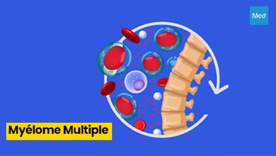 Myélome Multiple : Comprendre, Traiter, et Vivre Mieux