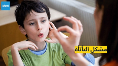 مشكل التأتأة