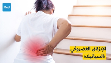 الإنزلاق الغضروفي (السياتيك): الأسباب والأعراض والتشخيص والعلاج