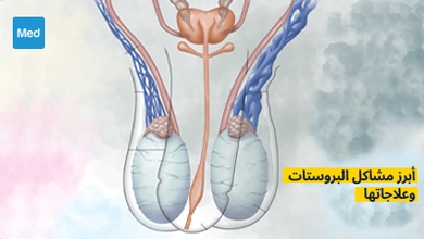 أبرز مشاكل البروستات وعلاجاتها