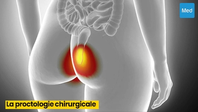 La Proctologie Chirurgicale : Une Approche Compréhensive