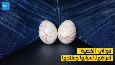 دوالي الخصية : أعراضها، أسبابها وعلاجها