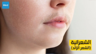 فهم الشعرانية (الشعر الزائد)