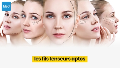 Les fils tenseurs APTOS: un lifting sans chirurgie