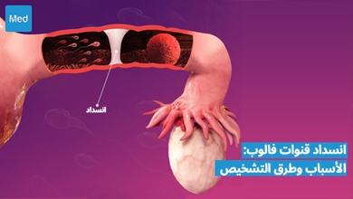 انسداد قنوات فالوب: الأسباب وطرق التشخيص