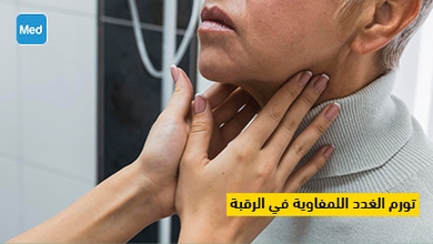 تورم الغدد اللمفاوية في الرقبة