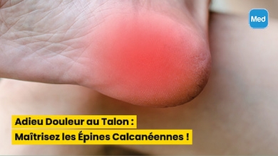 Adieu Douleur au Talon : Maîtrisez les Épines Calcanéennes !