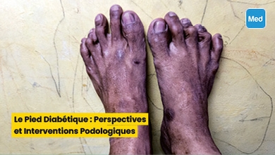 Le Pied Diabétique : Perspectives et Interventions Podologiques