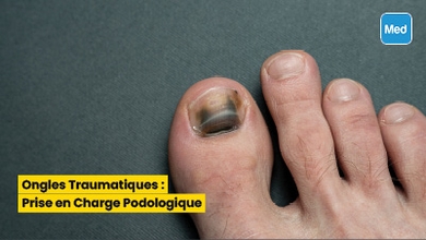 Ongles Traumatiques : Prise en Charge Podologique