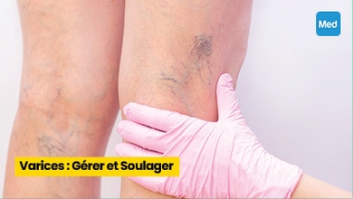 Varices : Gérer et Soulager